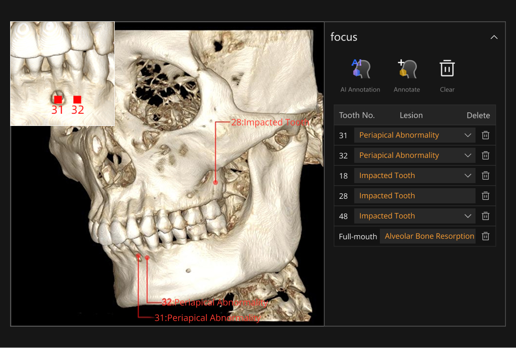 Smarter 3D AI-assisted diagnostics